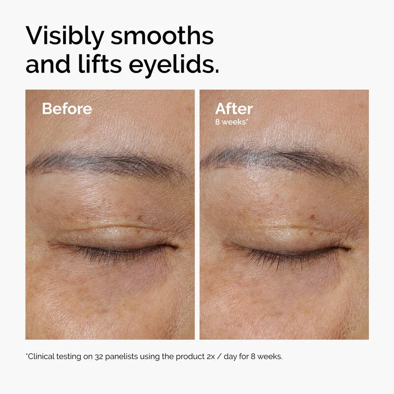 Lacto-PDRN* 4% + B9 Eye Cream