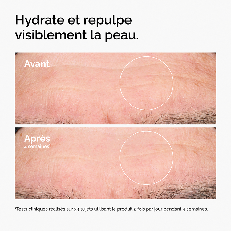 Hyaluronic Acid 2% + B5
