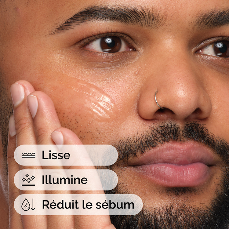 Niacinamide 10% + Zinc 1%