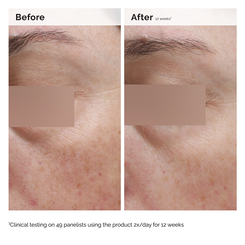 Natural Moisturizing Factors + Inulin Body Lotion